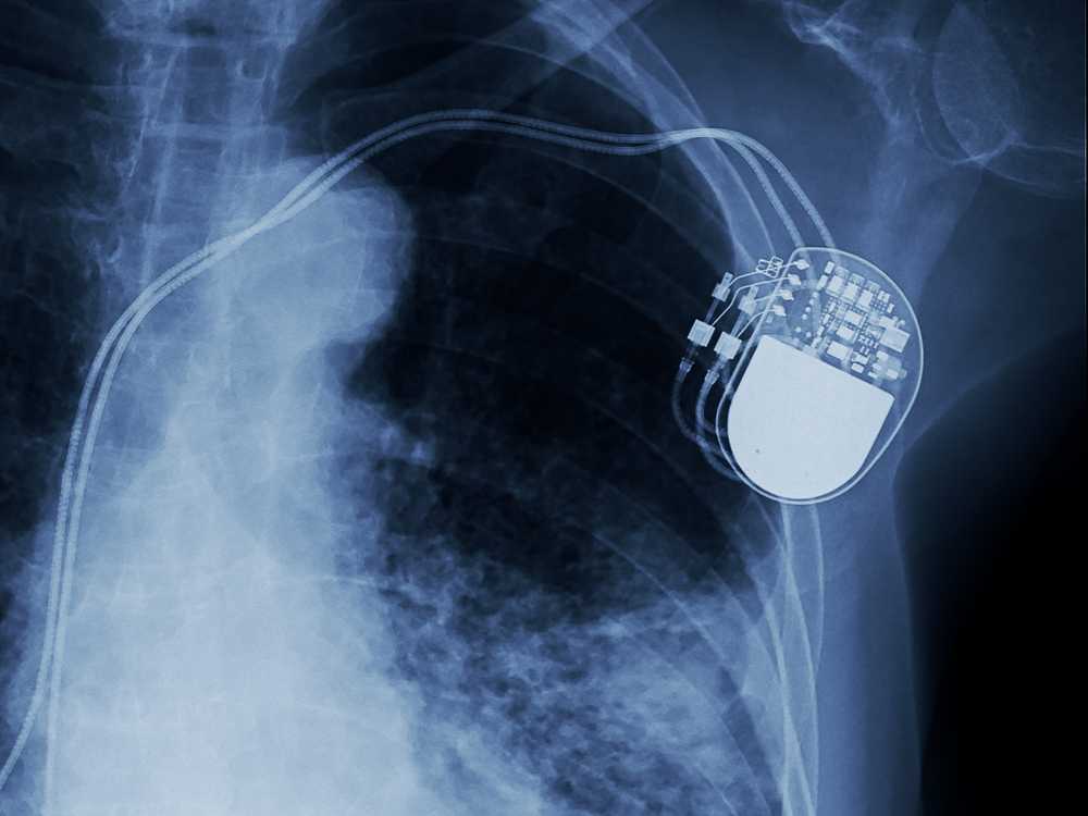 X ray ziekenhuis batterij